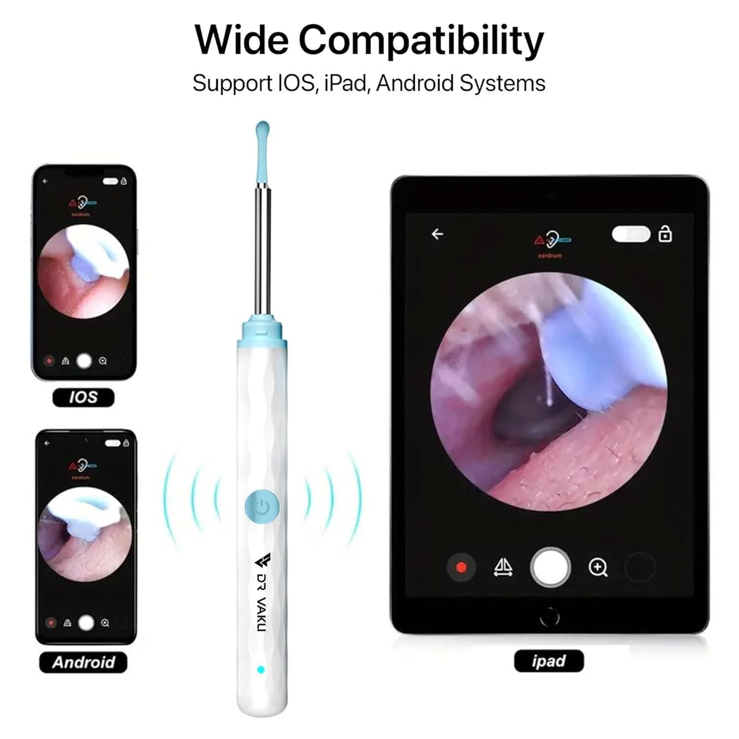 Smart Visual Ear Wax Cleaner with Wi-Fi Otoscope